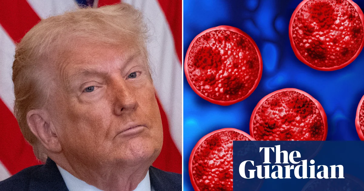 Les profondes coupes de Trump dans la santé publique entravent la réponse à l’épidémie record de cyclosporiase aux États-Unis