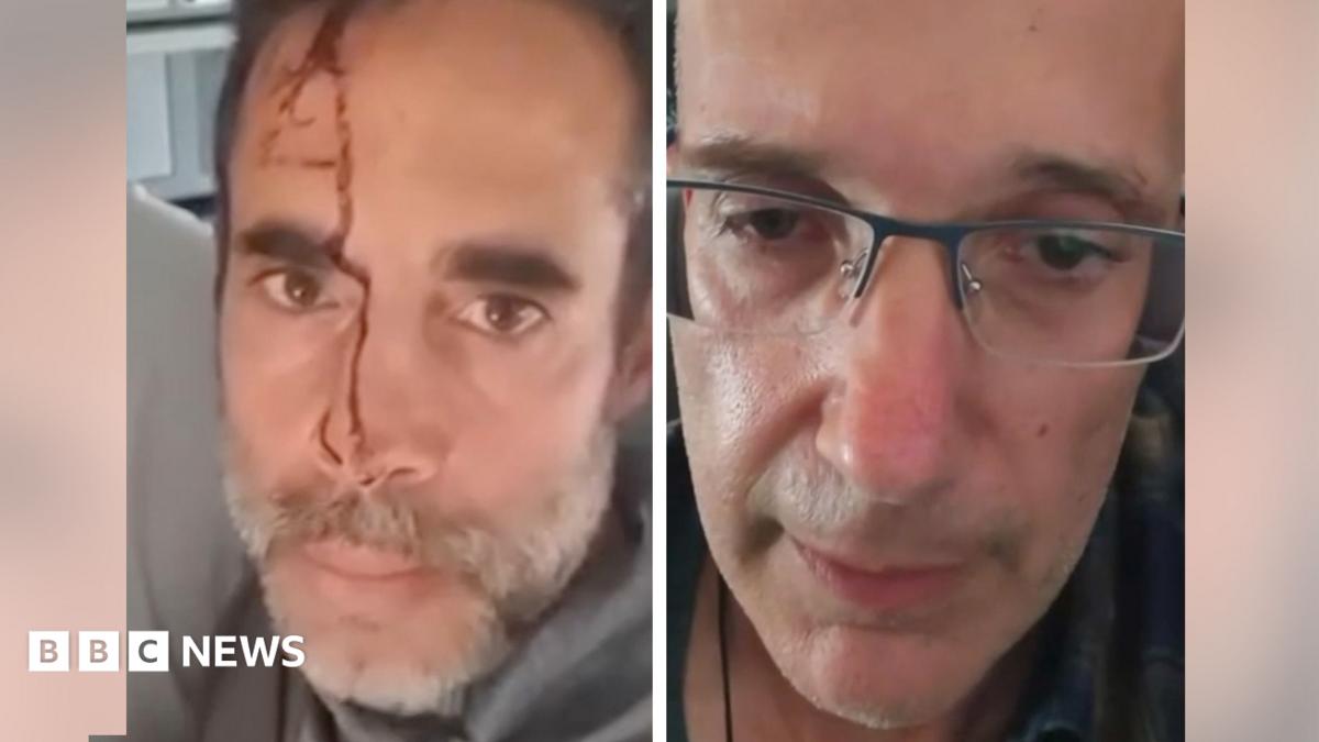 Watch: Passengers describe stabbing on Israel-bound plane